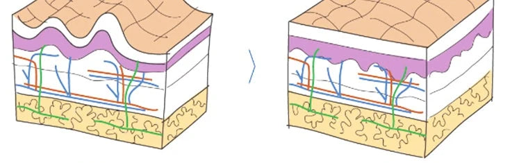 Illustration of skin layers, before and after (from the original page)