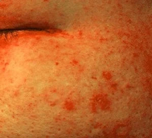 Skin before use, general pigmentation