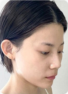시트를 떼어 낸 뒤 촉촉해 보이는 같은 여성의 피부, 자체 수분 테스트