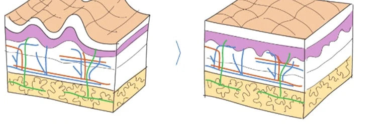 Illustration of skin layers, before and after (from the original page)