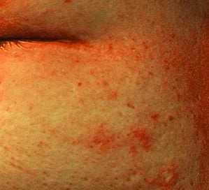 Skin after 4 weeks of use, general pigmentation