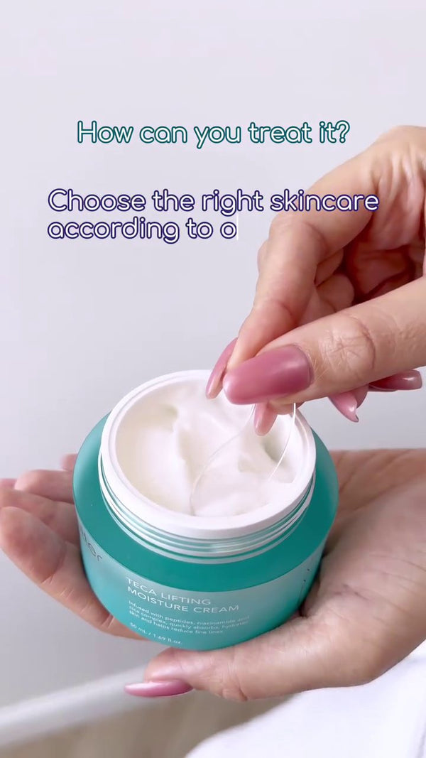 Video preview: Spring check-list for dry skin
